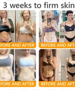 AWZLOVE® Bee Venom Comprehensive Cream