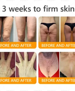 AWZLOVE® Bee Venom Comprehensive Cream