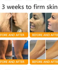 AWZLOVE® Bee Venom Comprehensive Cream