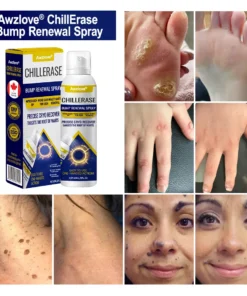 Awzlove® ChillErase Bump Renewal Spray