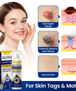 Awzlove® ChillErase Bump Renewal Spray