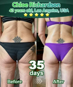 Awzlove® Luxurious Collagen & Stem Cell Anti-Cellulite Massage Oil