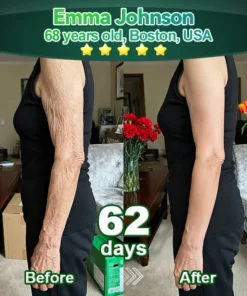 Awzlove® Luxurious Collagen & Stem Cell Anti-Cellulite Massage Oil